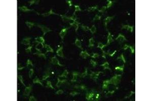 Immunofluorescence analysis of CA9 antibody with HeLa cells. (CA9 antibody  (AA 113-143))