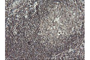 Image no. 2 for anti-Malignant T Cell Amplified Sequence 1 (MCTS1) (AA 1-181) antibody (ABIN1490598) (MCTS1 antibody  (AA 1-181))