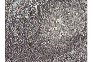 Image no. 2 for anti-Malignant T Cell Amplified Sequence 1 (MCTS1) (AA 1-181) antibody (ABIN1490598) (MCTS1 antibody  (AA 1-181))