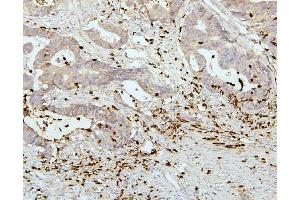 IHC analysis of PEF1 using anti-PEF1 antibody (ABIN6719632). (PEF1 antibody  (AA 170-284))