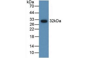 Detection of Recombinant AMH, Gallus using Polyclonal Antibody to Anti-Mullerian Hormone (AMH)