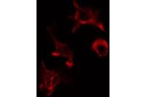 ABIN6275563 staining HuvEc cells by IF/ICC. (SH2B2 antibody  (N-Term))