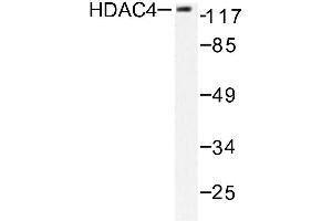 Image no. 1 for anti-Histone Deacetylase 4 (HDAC4) antibody (ABIN271891) (HDAC4 antibody)