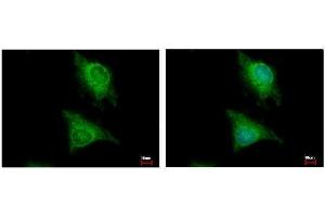 ICC/IF Image Laforin antibody [C2C3], C-term detects EPM2A protein at cytoplasm by immunofluorescent analysis.