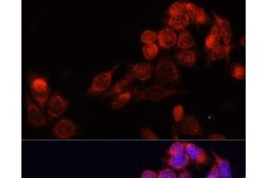 Immunofluorescence analysis of HeLa cells using SLC16A4 Polyclonal Antibody at dilution of 1:100. (SLC16A4 antibody)