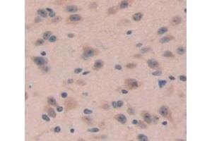 IHC-P analysis of Mouse Tissue, with DAB staining. (DKK4 antibody  (AA 37-141))