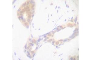 Image no. 1 for anti-Tumor Necrosis Factor alpha (TNF alpha) antibody (ABIN465675) (TNF alpha antibody)