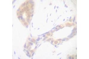 Image no. 1 for anti-Tumor Necrosis Factor alpha (TNF alpha) antibody (ABIN465674) (TNF alpha antibody)