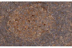 Immunohistochemistry (IHC) image for anti-Ribosomal Protein S6 Kinase, 70kDa, Polypeptide 1 (RPS6KB1) (pThr421) antibody (ABIN6256561)