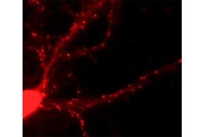 Immunofluorescence labeling of a hippocampus neuron (dilution 1 : 500). (SH3G2 antibody  (AA 256-276))
