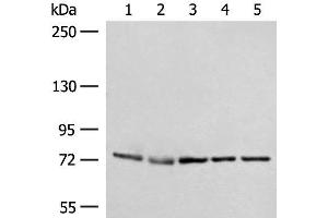 Western blot analysis of A172 231 Jurkat HepG2 and Hela cell lysates using POLH Polyclonal Antibody at dilution of 1:300 (POLH antibody)