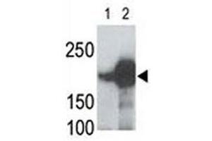 LRP5 antibody used in western blot to detect recombinant human LRP5 (Lane 1) and mouse LRP5 (2) proteins in transfected 293 cell lysate; Data is kindly provided by Drs. (LRP5 antibody  (AA 1538-1567))