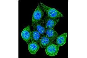 Confocal immunofluorescent analysis of RAD9A Antibody  with 293 cell followed by Alexa Fluor 488-conjugated Goat anti-Rabbit lgG (green). (RAD9A antibody)