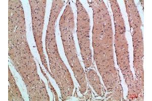 Immunohistochemical analysis of paraffin-embedded Human-colon, antibody was diluted at 1:100