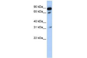ABCD4 antibody used at 1 ug/ml to detect target protein. (ABCD4 antibody)