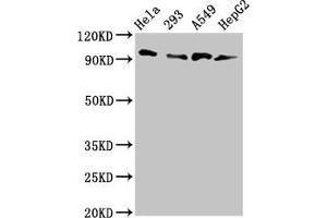 Western Blot Positive WB detected in: Hela whole cell lysate, 293 whole cell lysate, A549 whole cell lysate, HepG2 whole cell lysate All lanes: MACC1 antibody at 3 μg/mL Secondary Goat polyclonal to rabbit IgG at 1/50000 dilution Predicted band size: 97 kDa Observed band size: 97 kDa (MACC1 antibody  (AA 371-514))