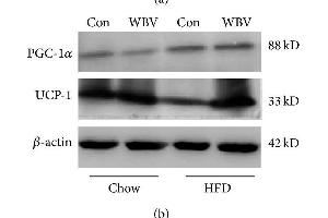 Protein expression of UCP1 and PGC-1α in WAT. (UCP1 antibody  (AA 101-200))
