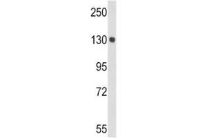 Western Blotting (WB) image for anti-Ceruloplasmin (Ferroxidase) (CP) (AA 547-577) antibody (ABIN3028563)