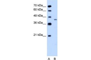 Western Blotting (WB) image for anti-Dihydroorotate Dehydrogenase (DHODH) antibody (ABIN2462506) (DHODH antibody)