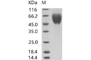 Western Blotting (WB) image for Sudan Ebola Virus Envelope Glycoprotein (SEBOV GP) protein (His tag,Mucin Tag) (ABIN7198917) (SEBOV GP Protein (His tag,Mucin Tag))