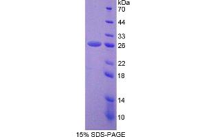 Image no. 1 for Proteasome 26S Subunit, Non ATPase 5 (AA 143-341) protein (His tag) (ABIN6238017) (Proteasome 26S Subunit, Non ATPase 5 (AA 143-341) protein (His tag))