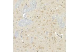 Immunohistochemistry of paraffin-embedded rat brain using CNTN4 Rabbit mAb (ABIN7266495) at dilution of 1:100 (40x lens). (Contactin 4 antibody)