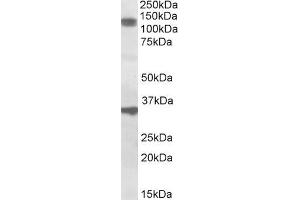 ABIN571087 (1µg/ml) staining of Rat Skeletal Muscle lysate (35µg protein in RIPA buffer).