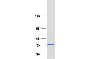 Western Blotting (WB) image for Retinaldehyde Binding Protein 1 (RLBP1) protein (Myc-DYKDDDDK Tag) (ABIN2730975)