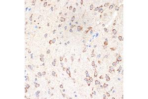 Immunohistochemistry of paraffin-embedded mouse brain using CYPOR Rabbit mAb (ABIN7269151) at dilution of 1:100 (40x lens). (POR antibody)
