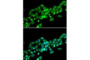 Immunofluorescence analysis of MCF-7 cell using RASSF1 antibody. (RASSF1 antibody  (AA 101-340))