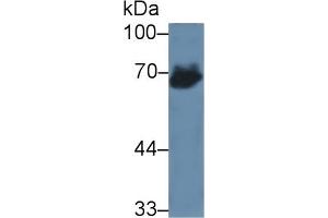 Rabbit Detection antibody from the kit in WB with Positive Control: Human lung lysate. (alpha Fetoprotein CLIA Kit)