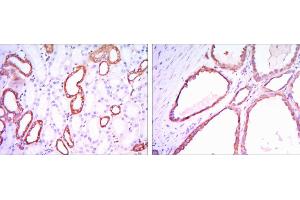 Immunohistochemical analysis of paraffin-embedded kidney tissues using HK1 mouse mAb with DAB staining.