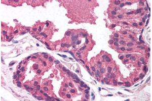 Human Prostate (formalin-fixed, paraffin-embedded) stained with EGLN2 antibody ABIN214100 at 5 ug/ml followed by biotinylated goat anti-rabbit IgG secondary antibody ABIN481713, alkaline phosphatase-streptavidin and chromogen. (PHD1 antibody  (AA 58-107))