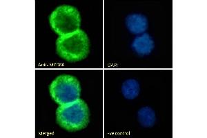 (ABIN185362) Immunofluorescence analysis of paraformaldehyde fixed Jurkat cells, permeabilized with 0. (MYD88 antibody  (Internal Region))