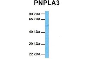 Western Blotting (WB) image for anti-Patatin-Like phospholipase Domain Containing 3 (PNPLA3) (C-Term) antibody (ABIN2783569)