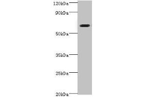 Western blot All lanes: SHC4 antibody at 6 μg/mL + Jurkat whole cell lysate Secondary Goat polyclonal to rabbit IgG at 1/10000 dilution Predicted band size: 69, 43 kDa Observed band size: 69 kDa (SHC4 antibody  (AA 1-185))