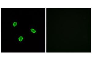 Immunofluorescence analysis of A549 cells, using SSTR1 antibody. (SSTR1 antibody  (N-Term))