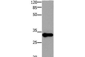 Western Blot analysis of Mouse testis tissue using ADO Polyclonal Antibody at dilution of 1:1200 (ADO antibody)