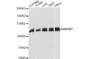 Western blot analysis of extracts of various cell lines, using ABI3BP antibody. (ABI3BP antibody)