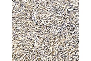 IHC analysis of GRID2 using anti-GRID2 antibody (ABIN7603172). (GRID2 antibody  (N-Term))