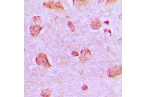 Immunohistochemical analysis of NDUFA4 staining in human brain formalin fixed paraffin embedded tissue section. (NDUFA4 antibody  (C-Term))