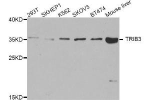 Western blot analysis of extracts of various cell lines, using TRIB3 antibody. (TRIB3 antibody)