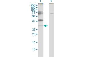 Western Blotting (WB) image for anti-Proteolipid Protein 1 (PLP1) (AA 1-277) antibody (ABIN950033)