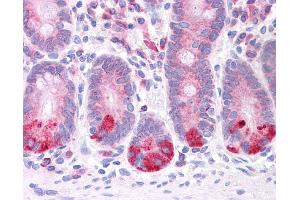 Immunohistochemistry (IHC) image for anti-Leucine Rich Repeat Containing 59 (LRRC59) (N-Term) antibody (ABIN2783711) (LRRC59 antibody  (N-Term))