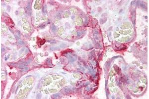Anti-UBE2F antibody IHC staining of human placenta.