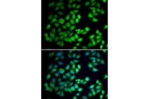 Immunofluorescence analysis of A549 cell using WDR77 antibody. (WDR77 antibody)