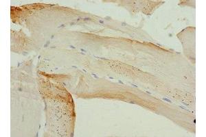 Immunohistochemistry of paraffin-embedded human skeletal muscle tissue using ABIN7163187 at dilution of 1:100 (PIP5K1B antibody  (AA 190-470))