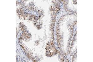 Immunohistochemical staining (Formalin-fixed paraffin-embedded sections) of human prostate with LTBP2 polyclonal antibody  shows strong cytoplasmic positivity in a granular pattern in glandular cells at 1:500-1:1000 dilution. (LTBP2 antibody)