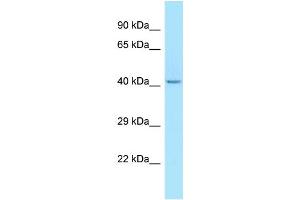 WB Suggested Anti-LIPK Antibody Titration: 1. (LIPK antibody  (N-Term))