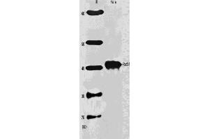 Western Blotting (WB) image for anti-DNA Repair Protein Homolog 1 (RAD51) antibody (ABIN2452093) (RAD51 antibody)